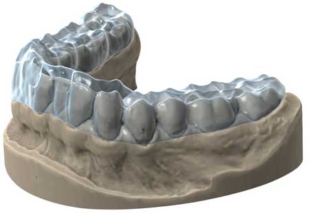 exocad módulo bite splint