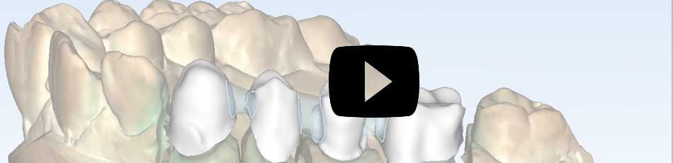 ortho studio video en youtube