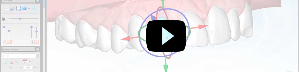 ortho studio video en youtube